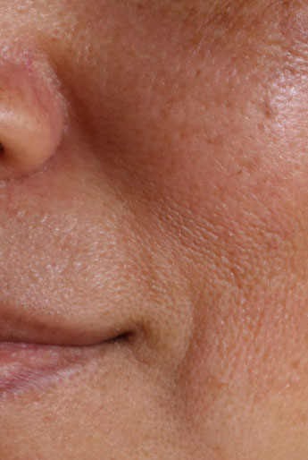 Daniela Aidar - Dermatologia